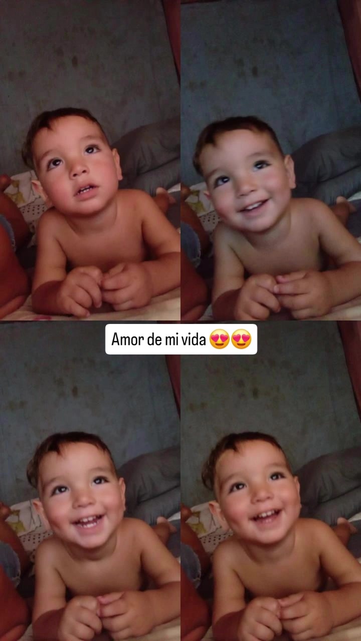 @Elii Xiomi
