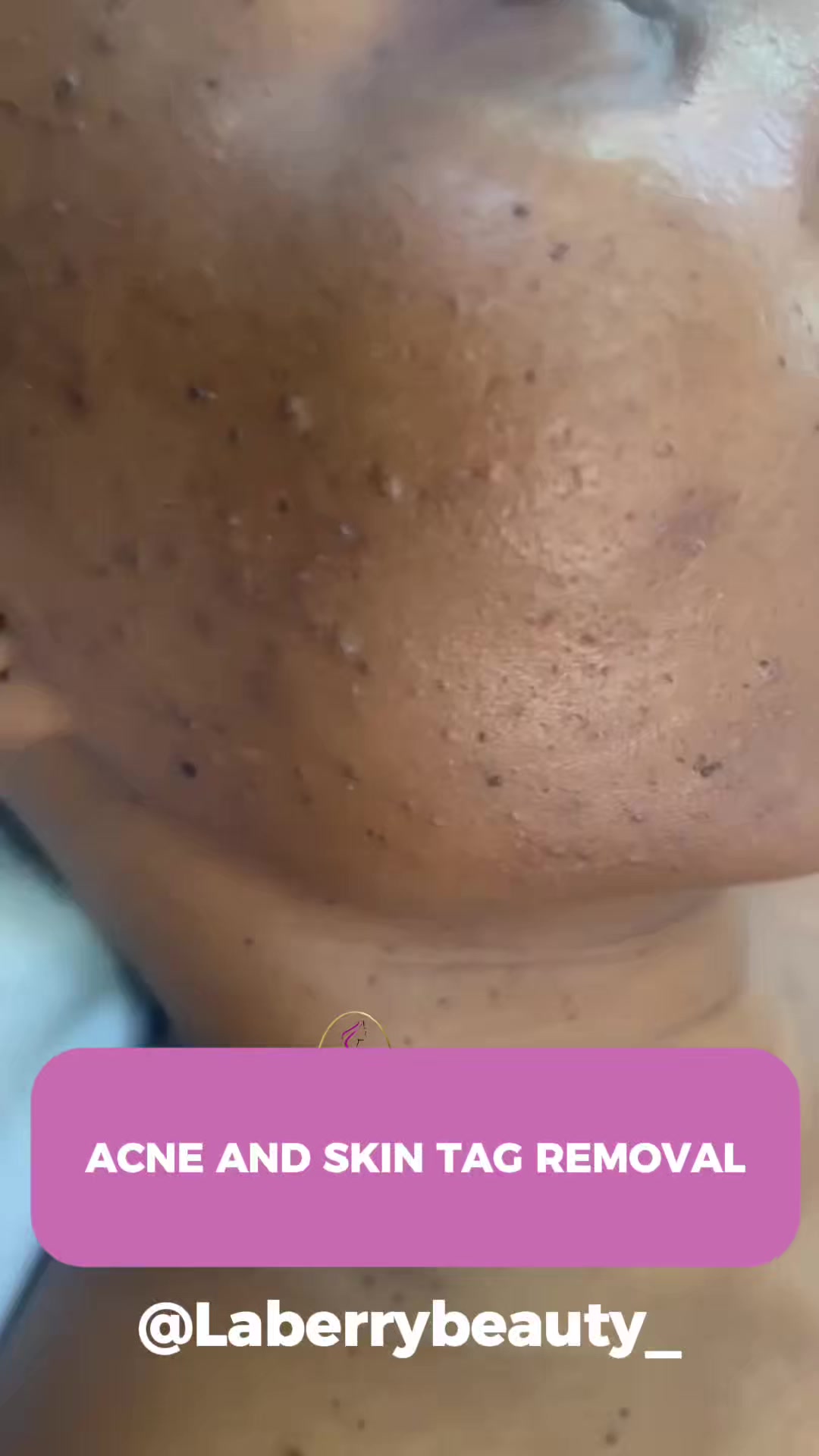 @LaBerry | Luxury Medspa Lagos