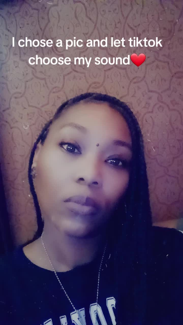 @Vitiligo_Diva