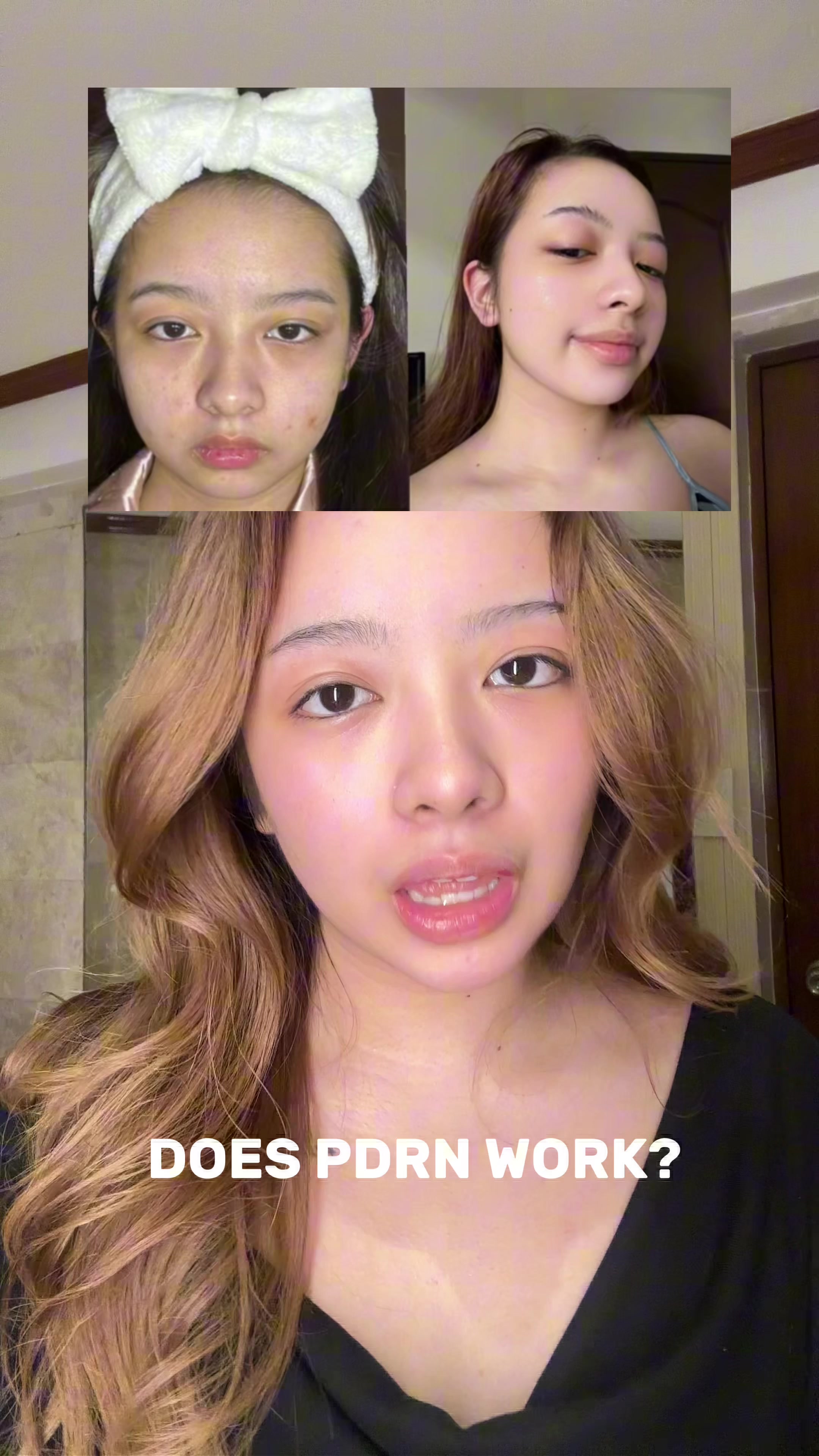 @Mitch Briones