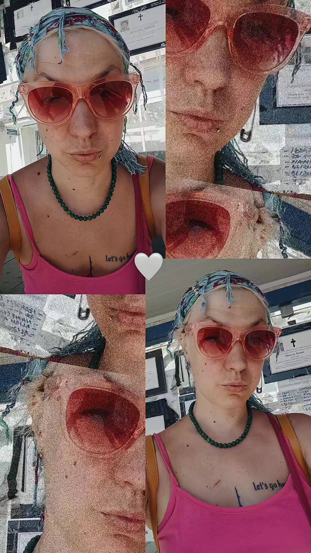 @Tijana Dementia