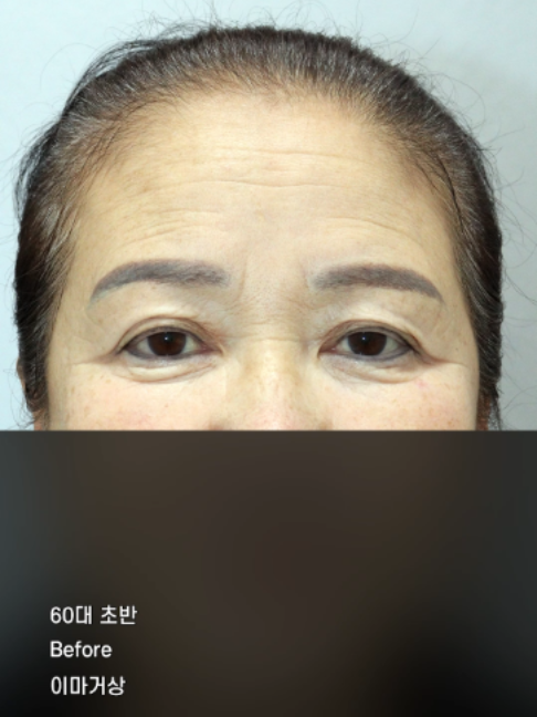 @다시피움성형외과 DASIPIUM タシピウム
