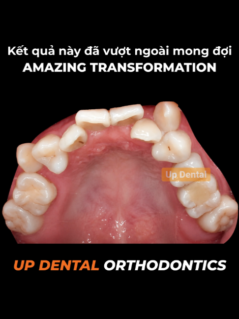 @Nha khoa niềng răng Up Dental