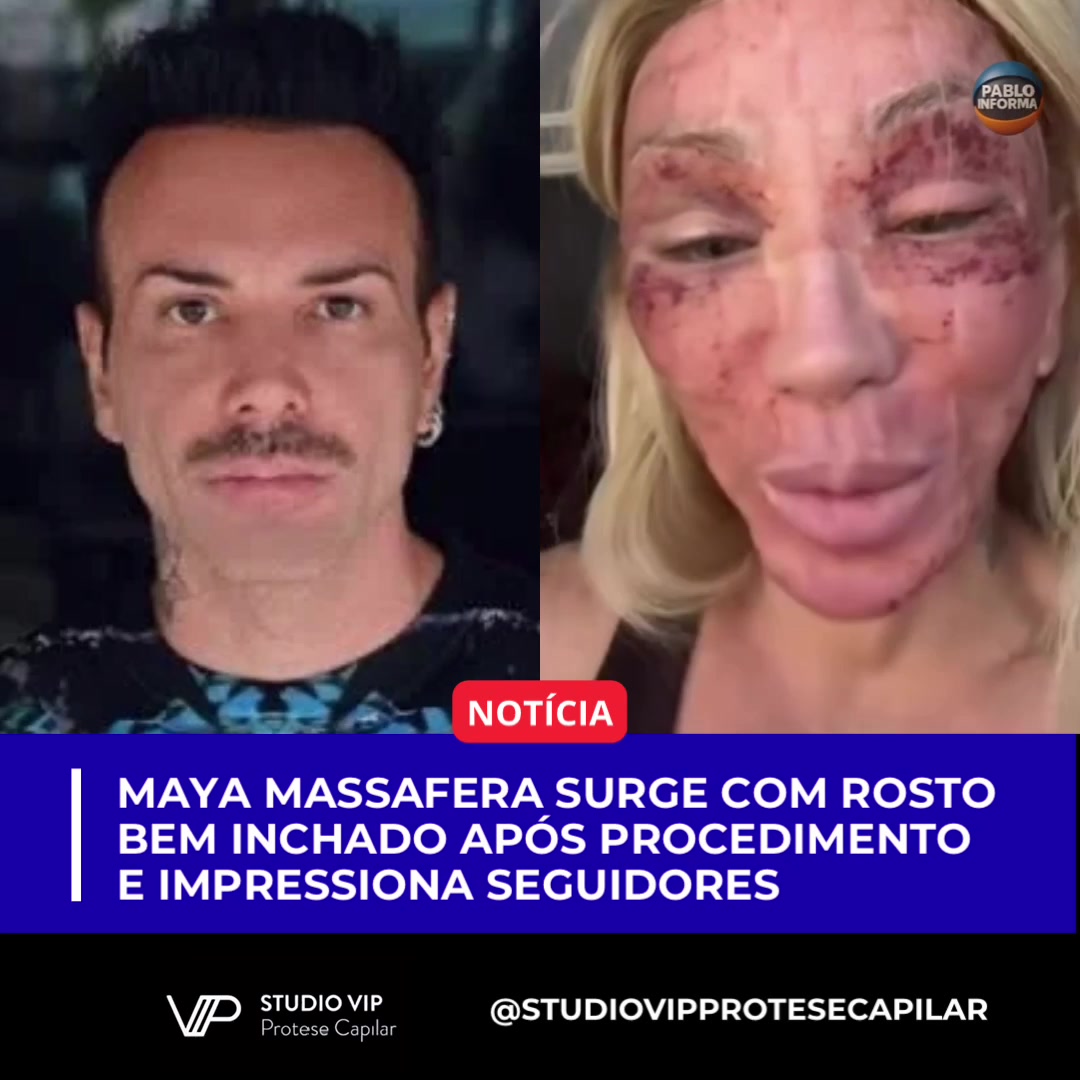 @Pablo Informa