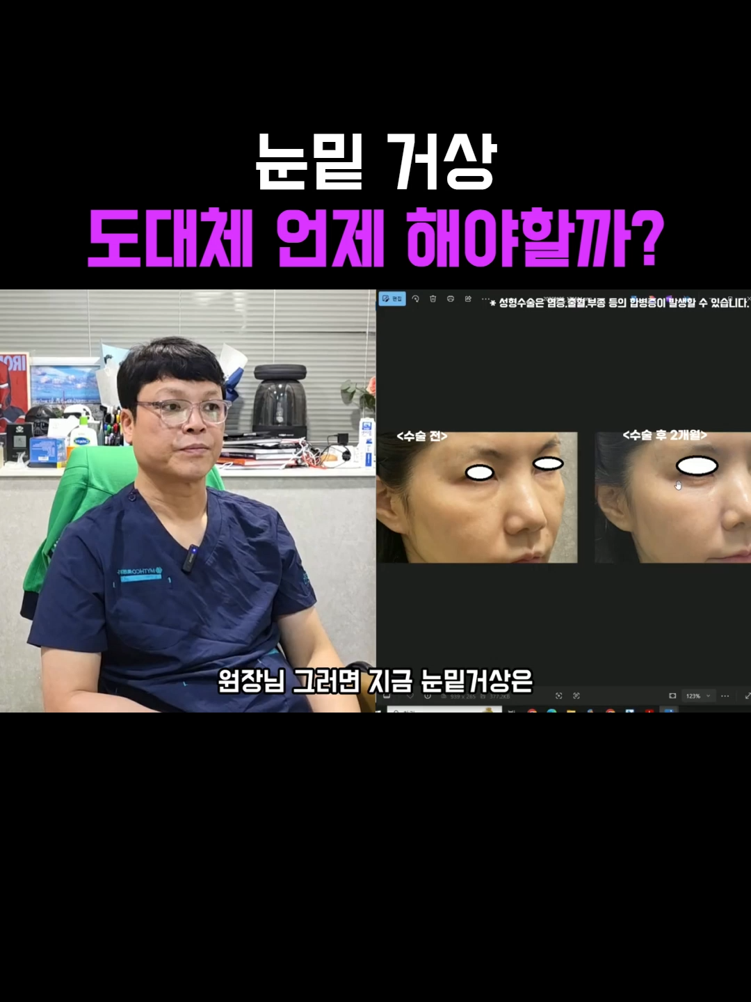 @미오름성형외과