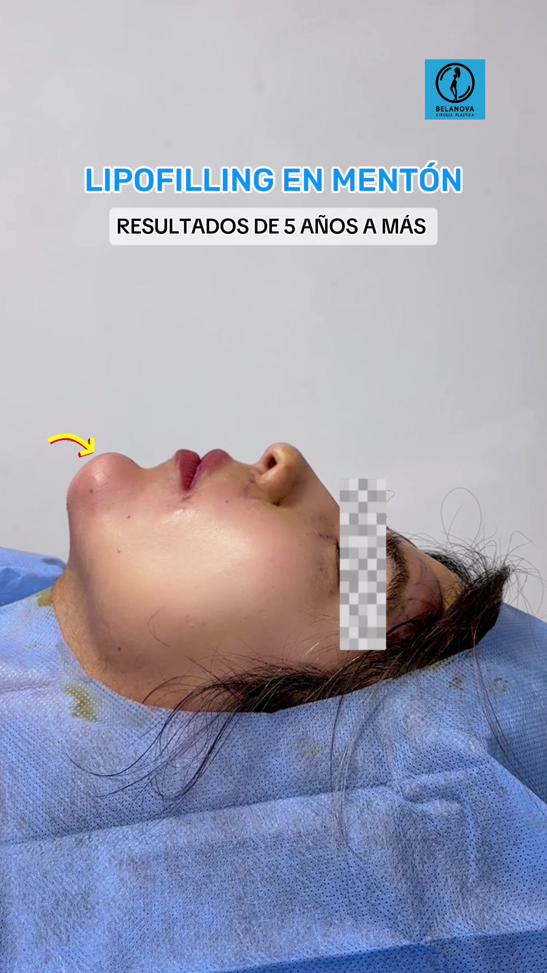 @Belanovacirugiaplastica