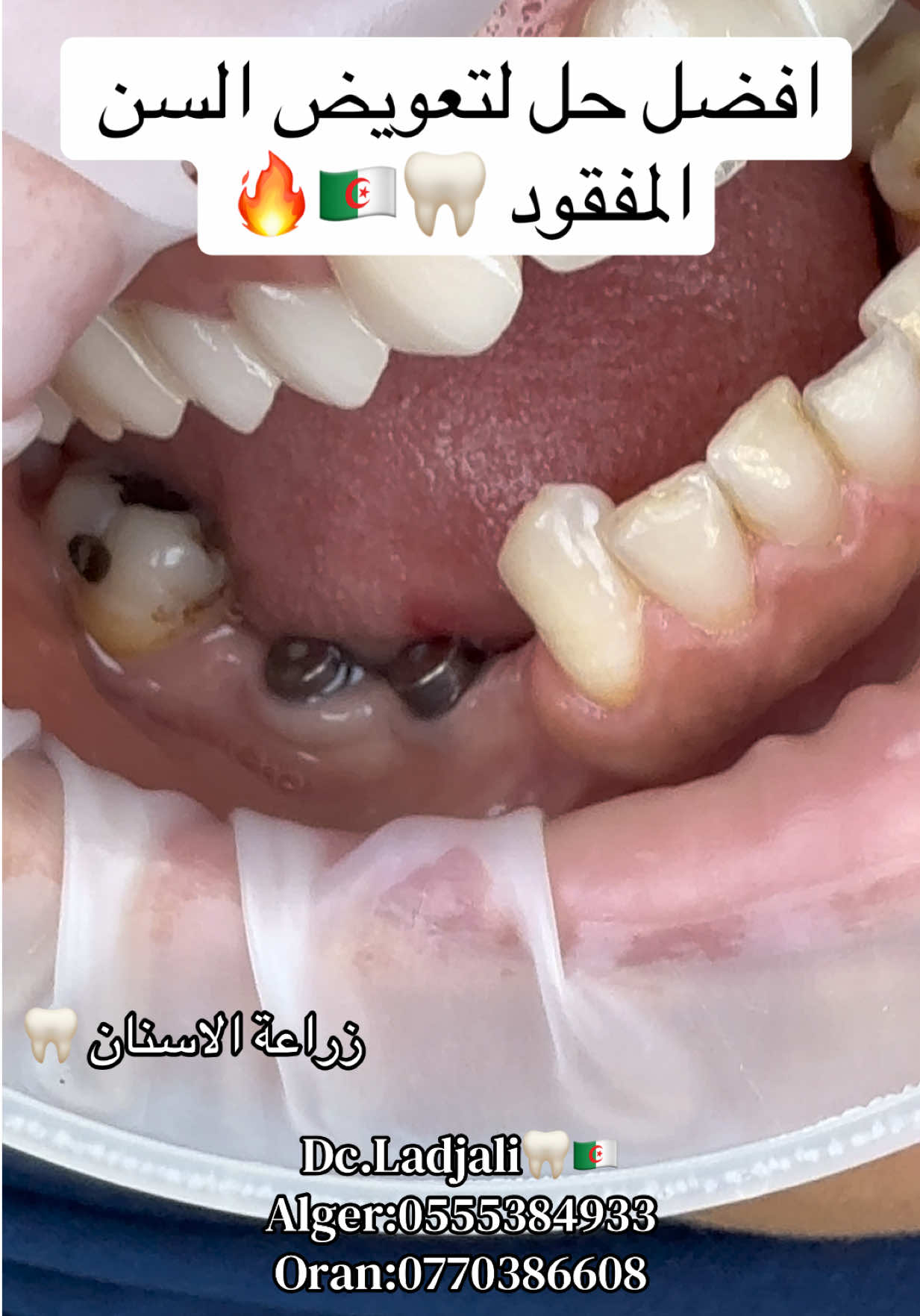 @Dr.ladjali