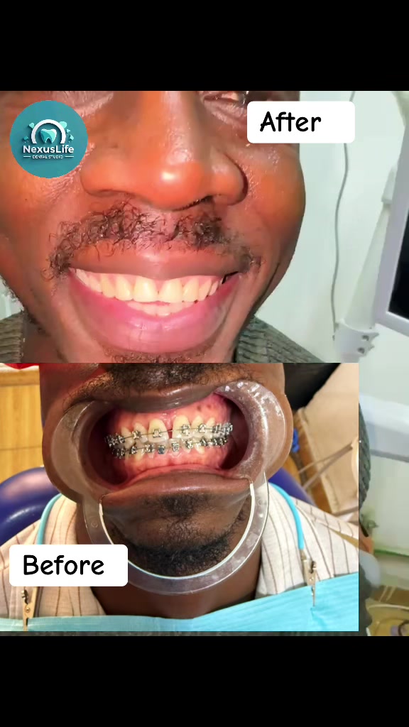 @NEXUSLIFE DENTAL CLINIC🦷