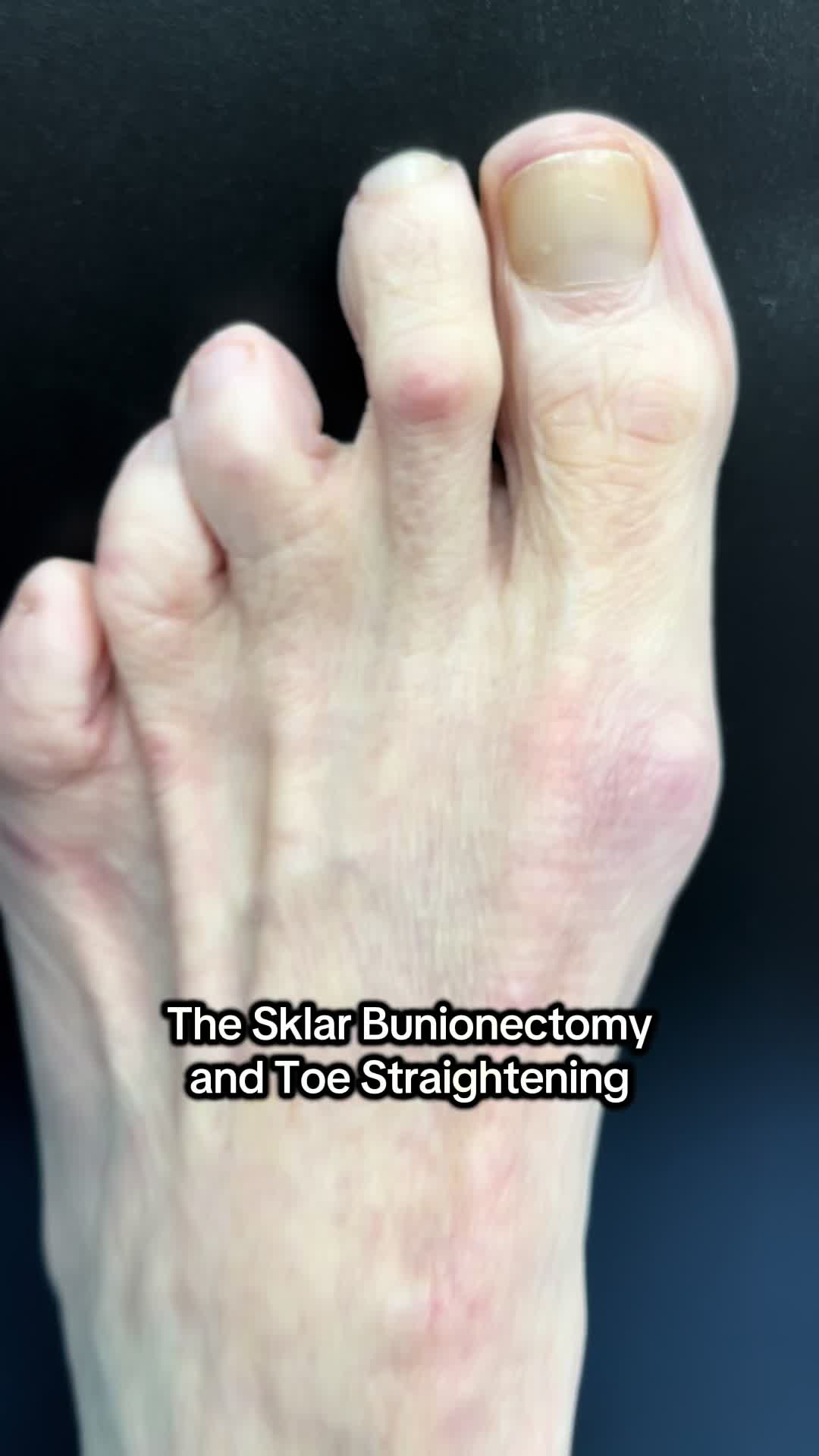 @Foot First Podiatry