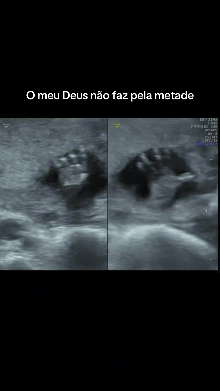 @aendomulhereendomae