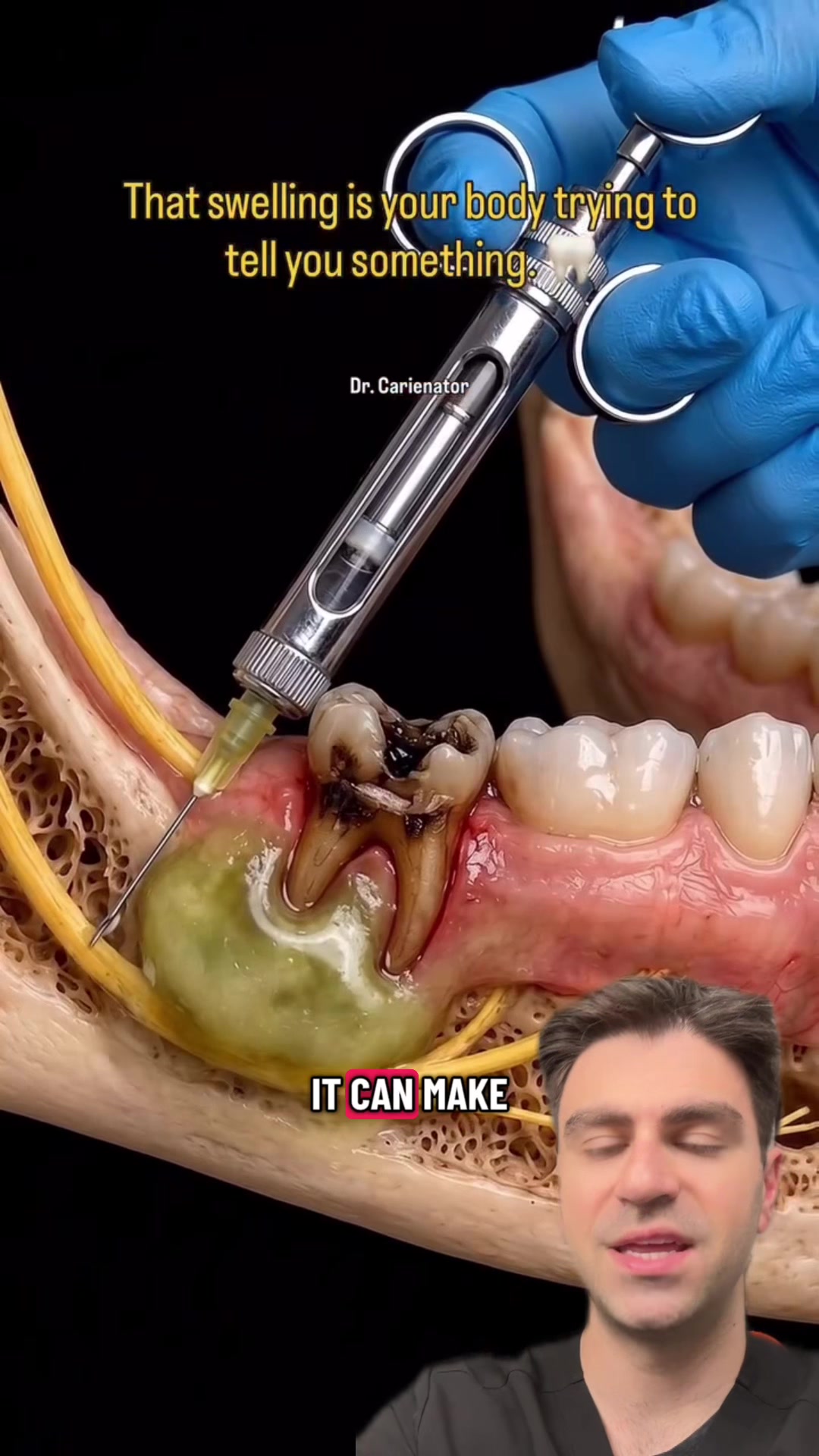 @Dr. Kadish