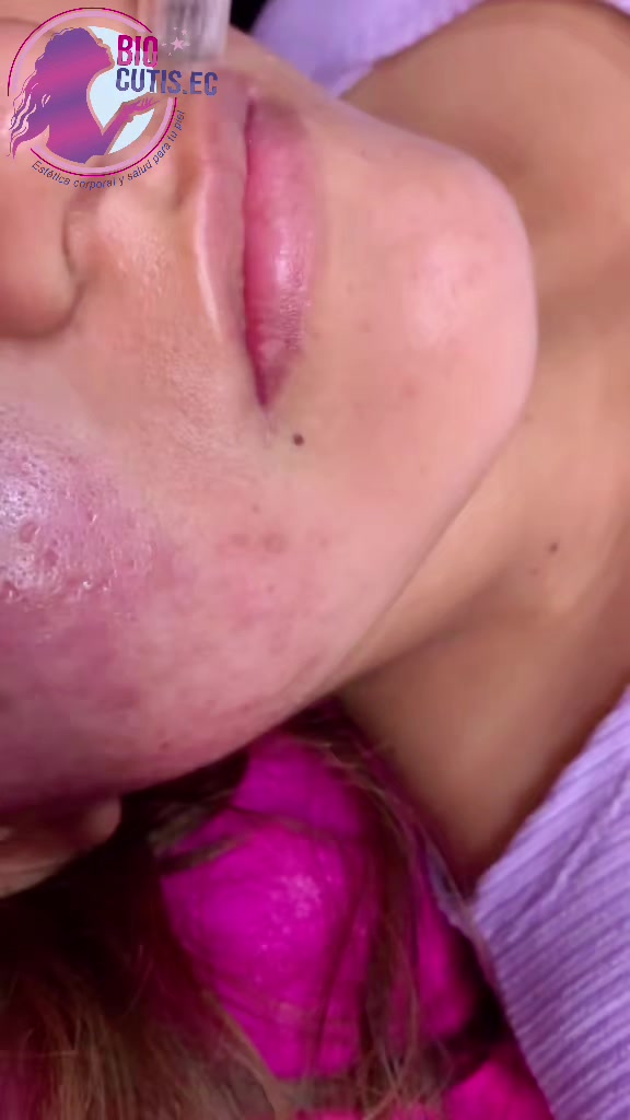 @BIOCUTIS ESTÉTICA ECUADOR