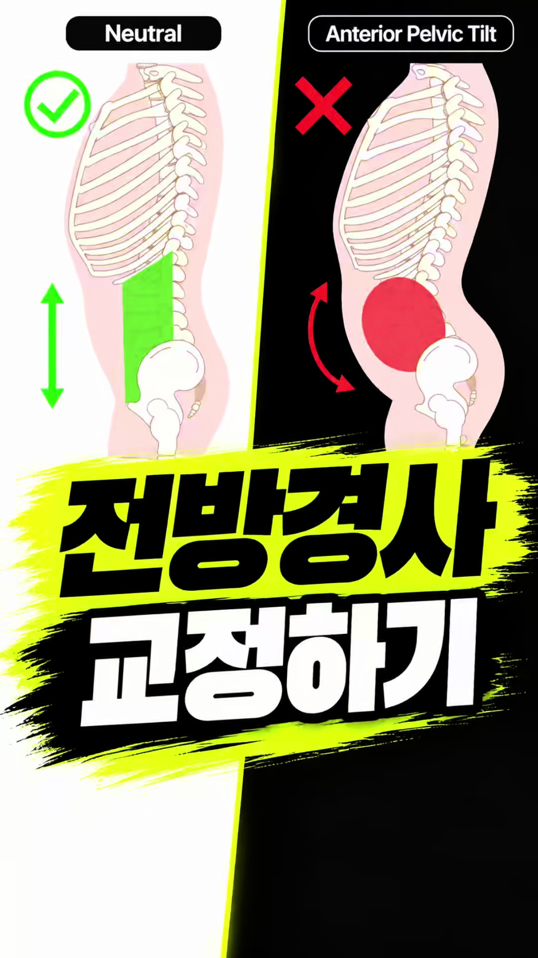@재활운동촤이