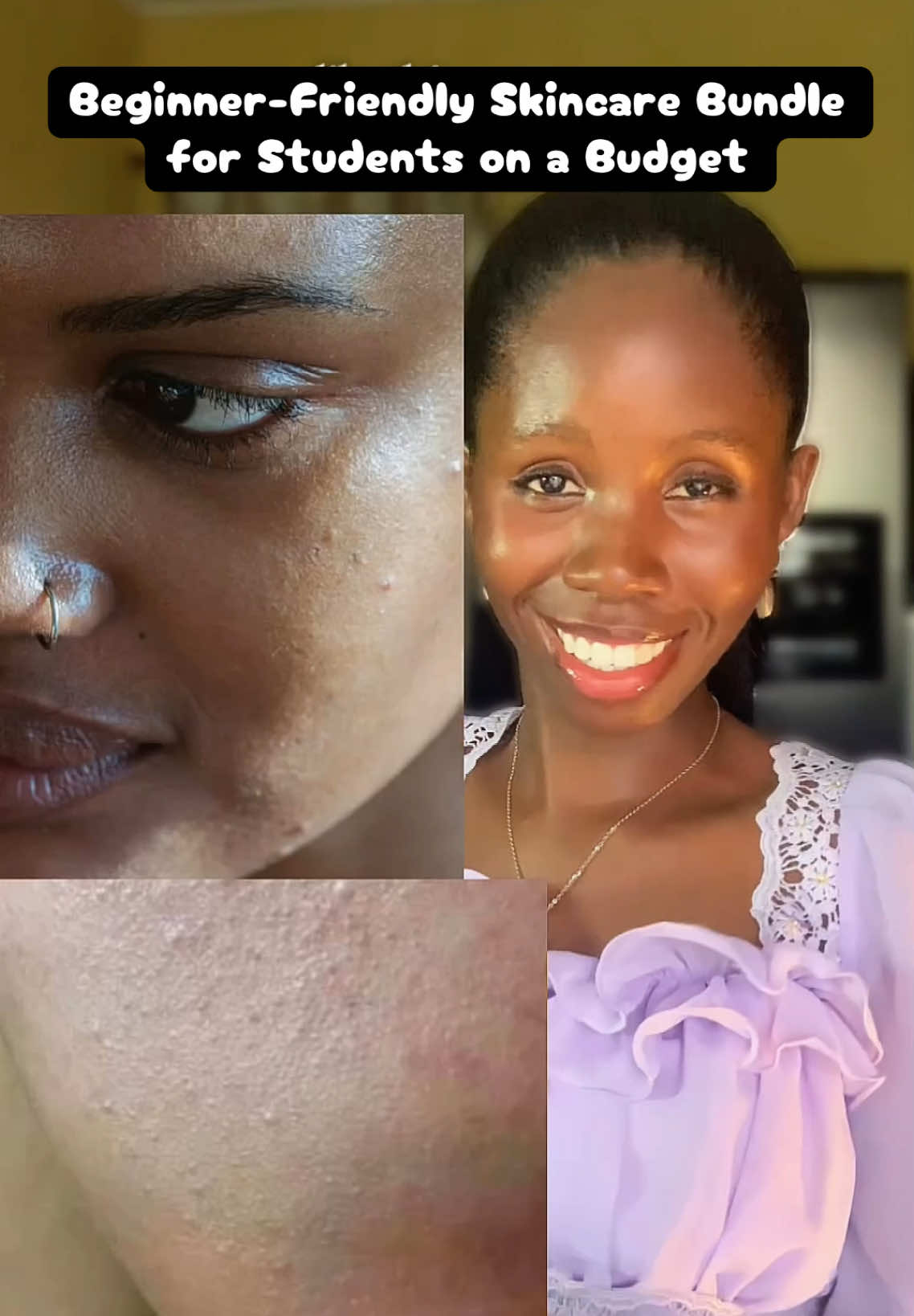 @Bimt Glow Skincare