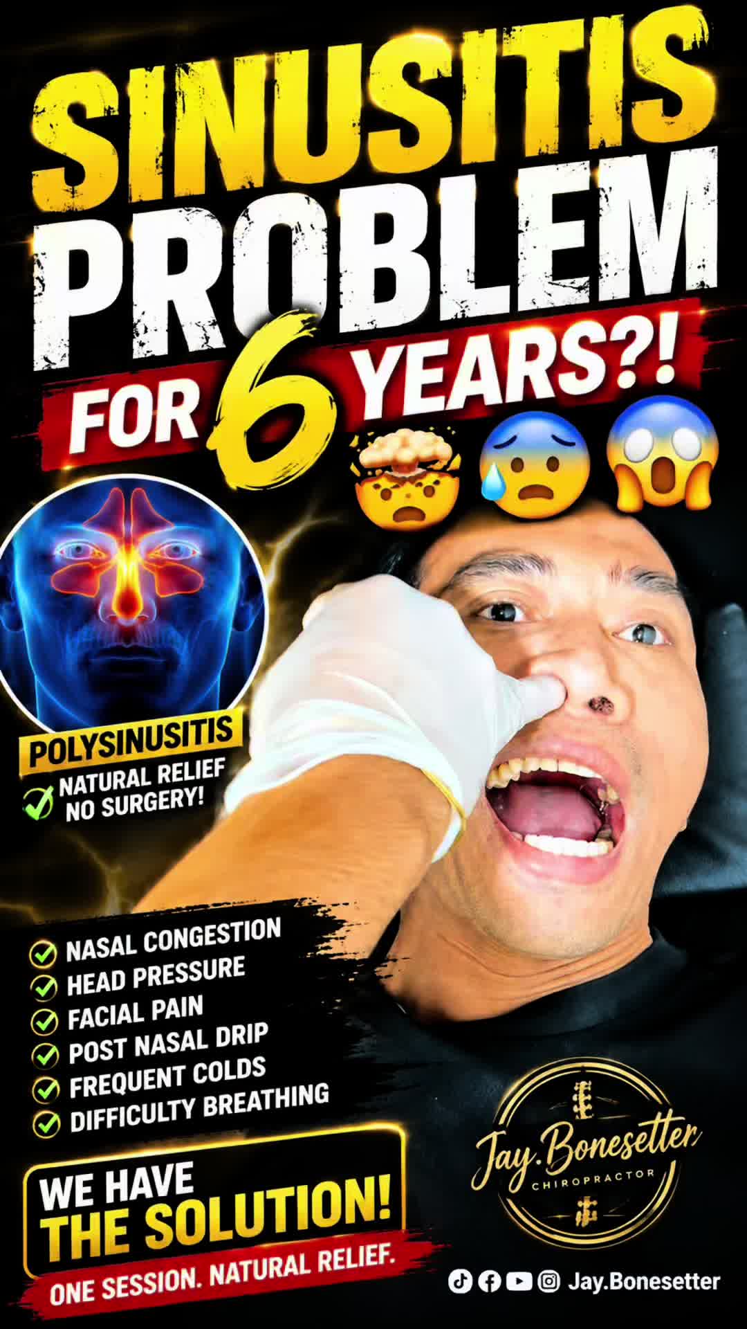 @Jay - Bonesetter