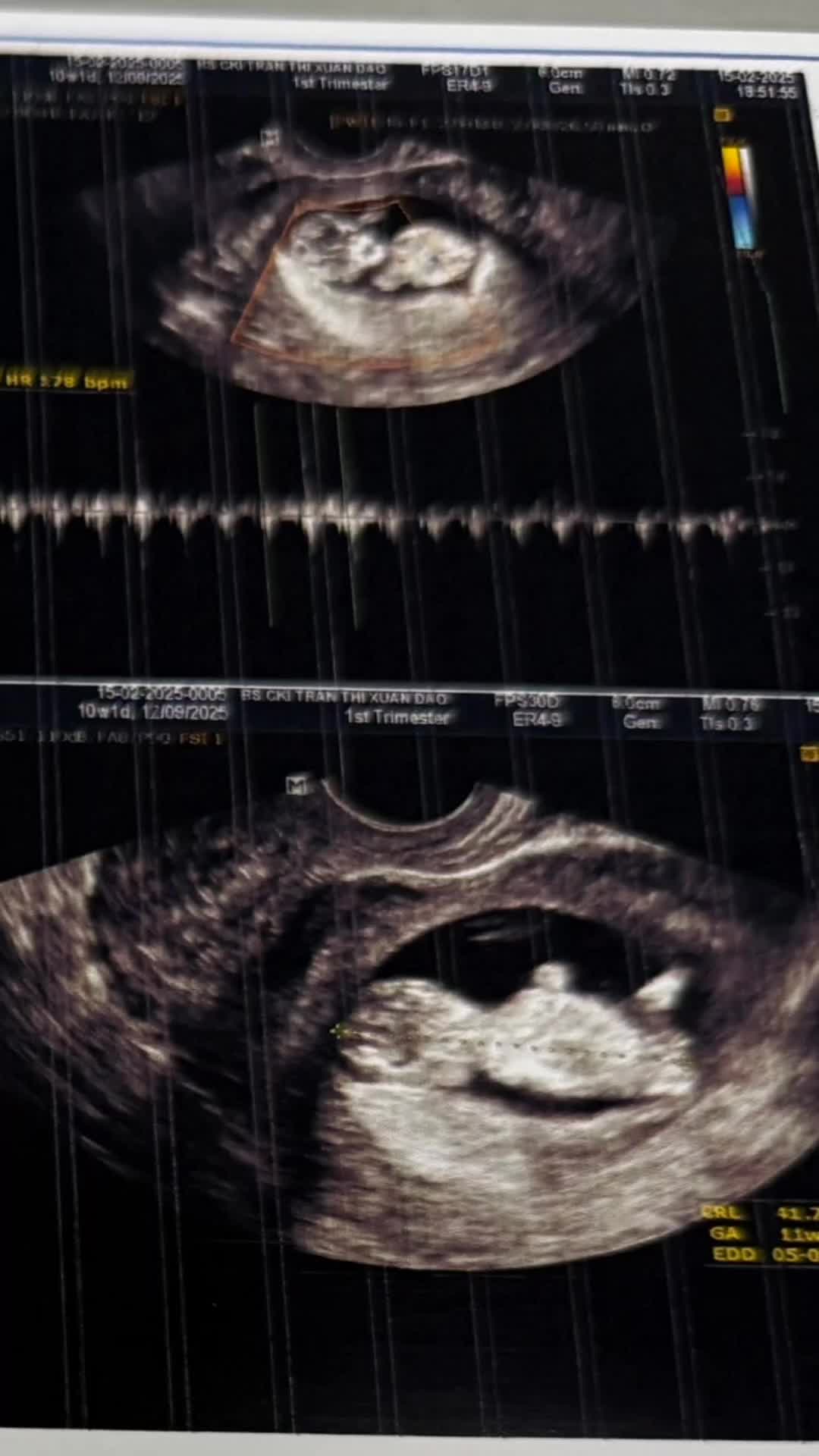 @Hót nhất là em 🪼🪼