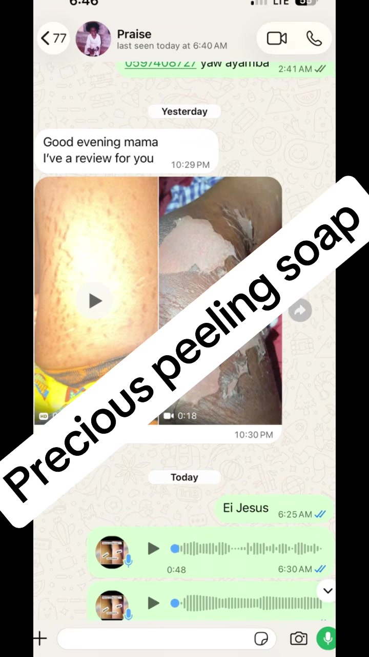 @@ Precious peeling soap