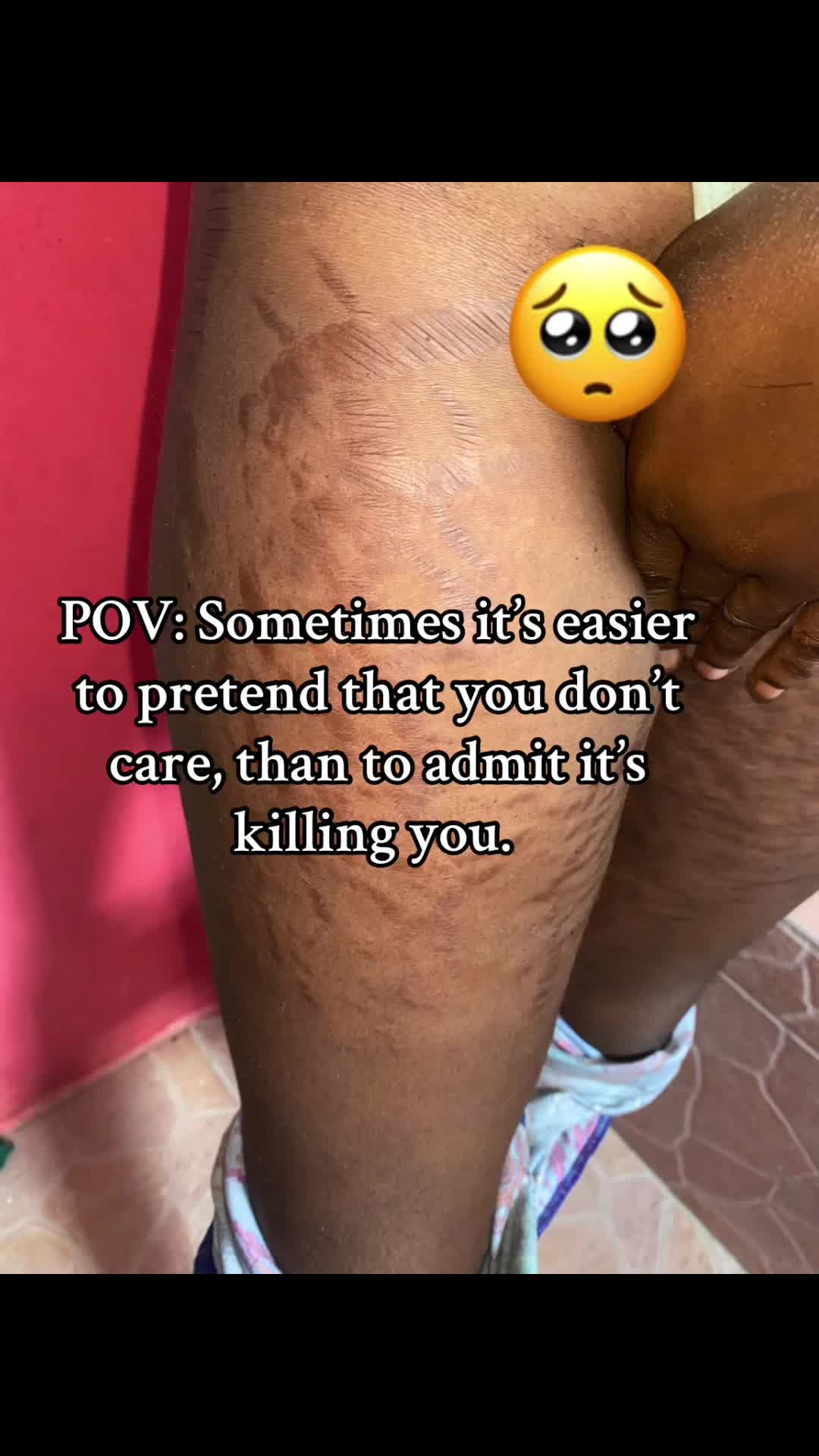 @Stretch_markeraser