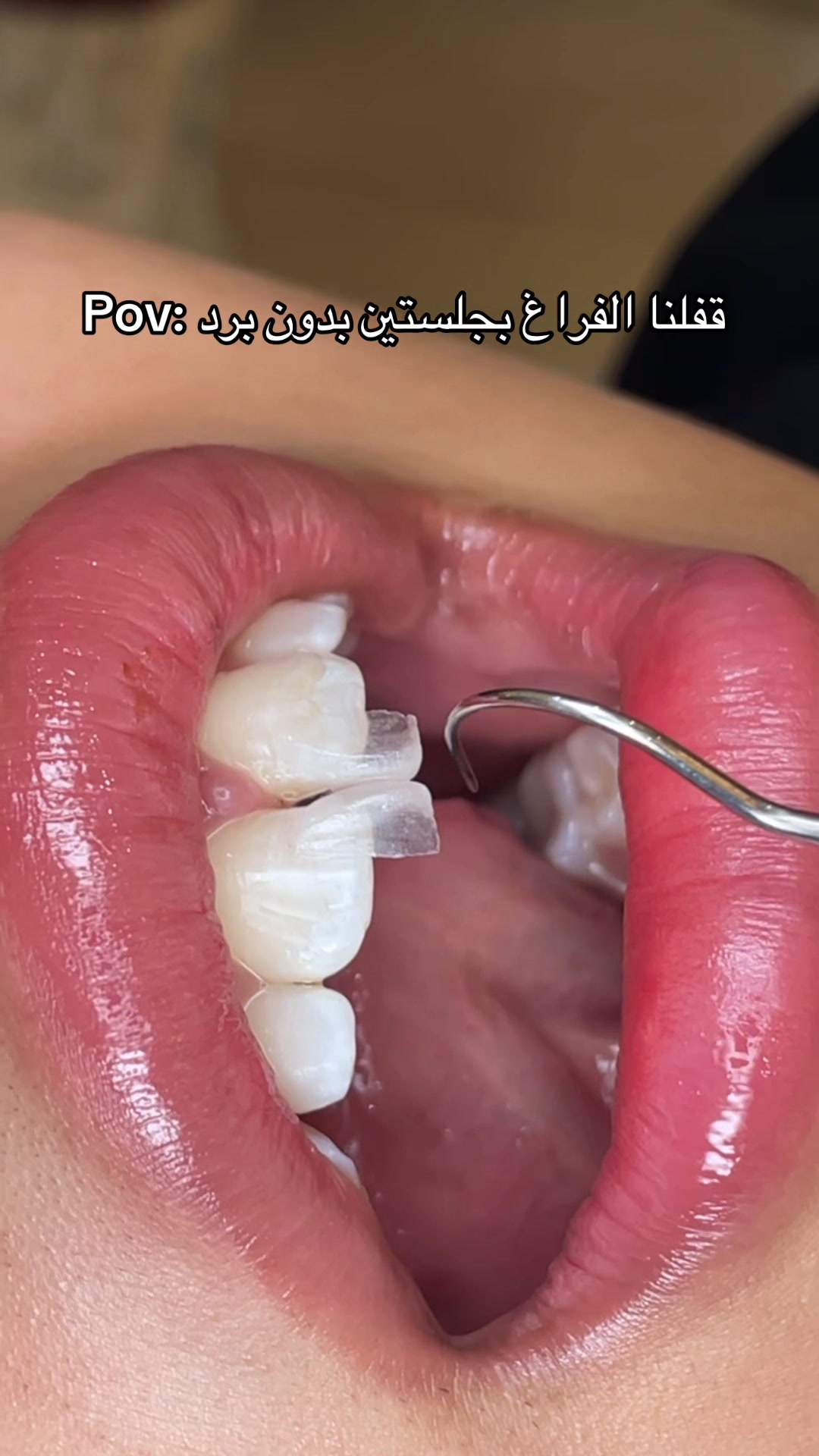 @Dr. Abrar Alhababi