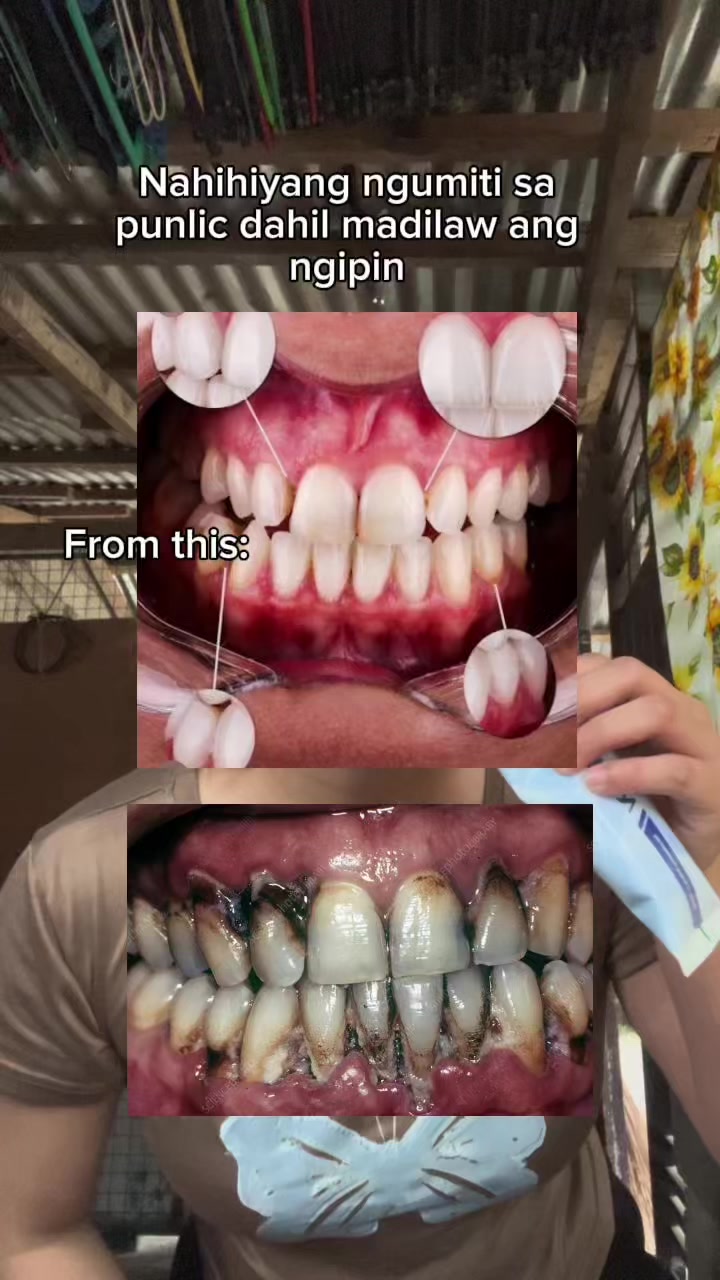 @𝐌𝐨𝐦𝐦𝐲 𝐀𝐛𝐛𝐲