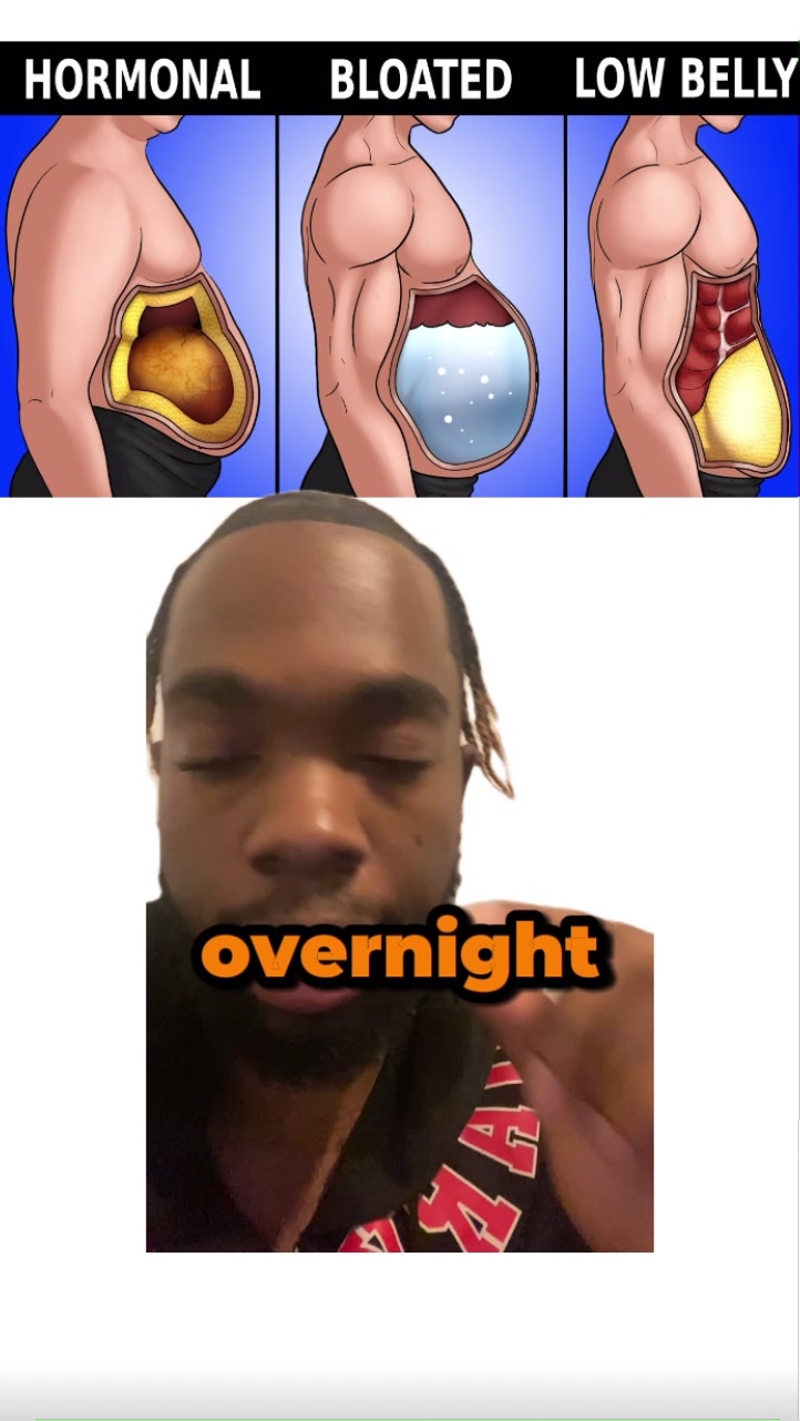 @Skobitherula 🔱