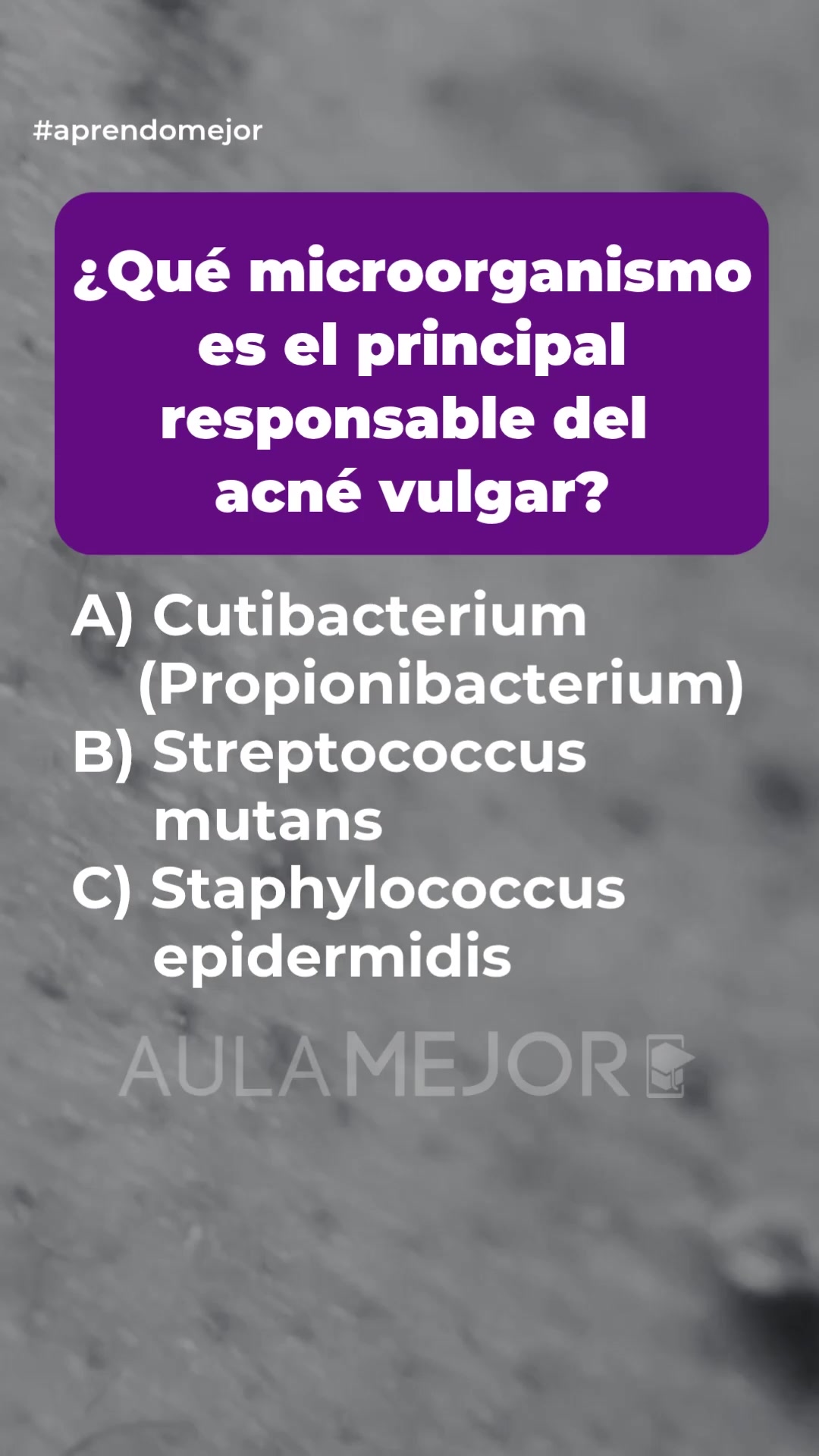 @Aula MEJOR