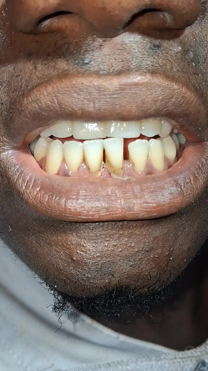 @Djoballa le dentiste