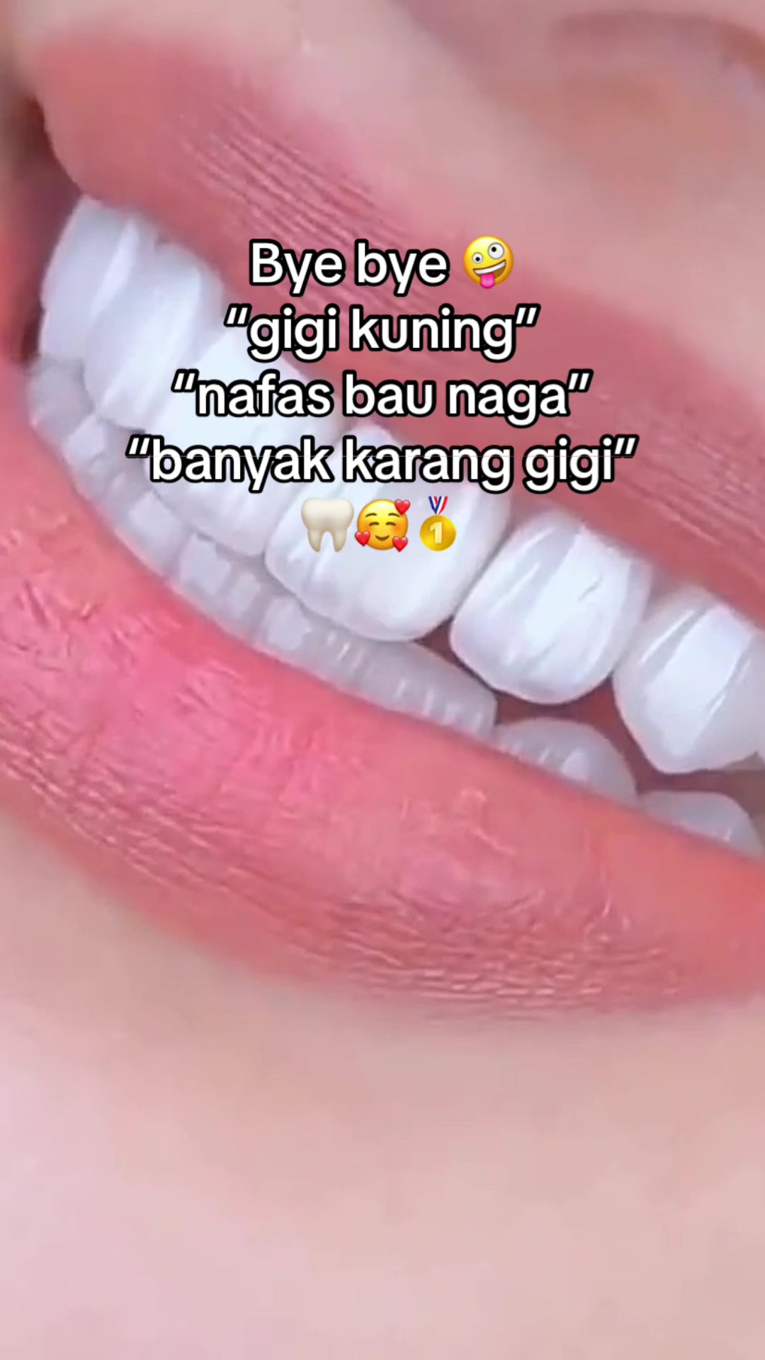 @Gigi Putih Berkilau🦷✨