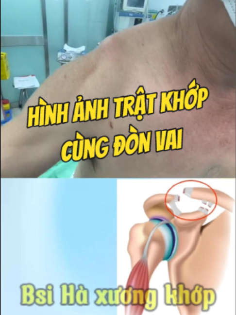 @Chuyên gia xương khớp