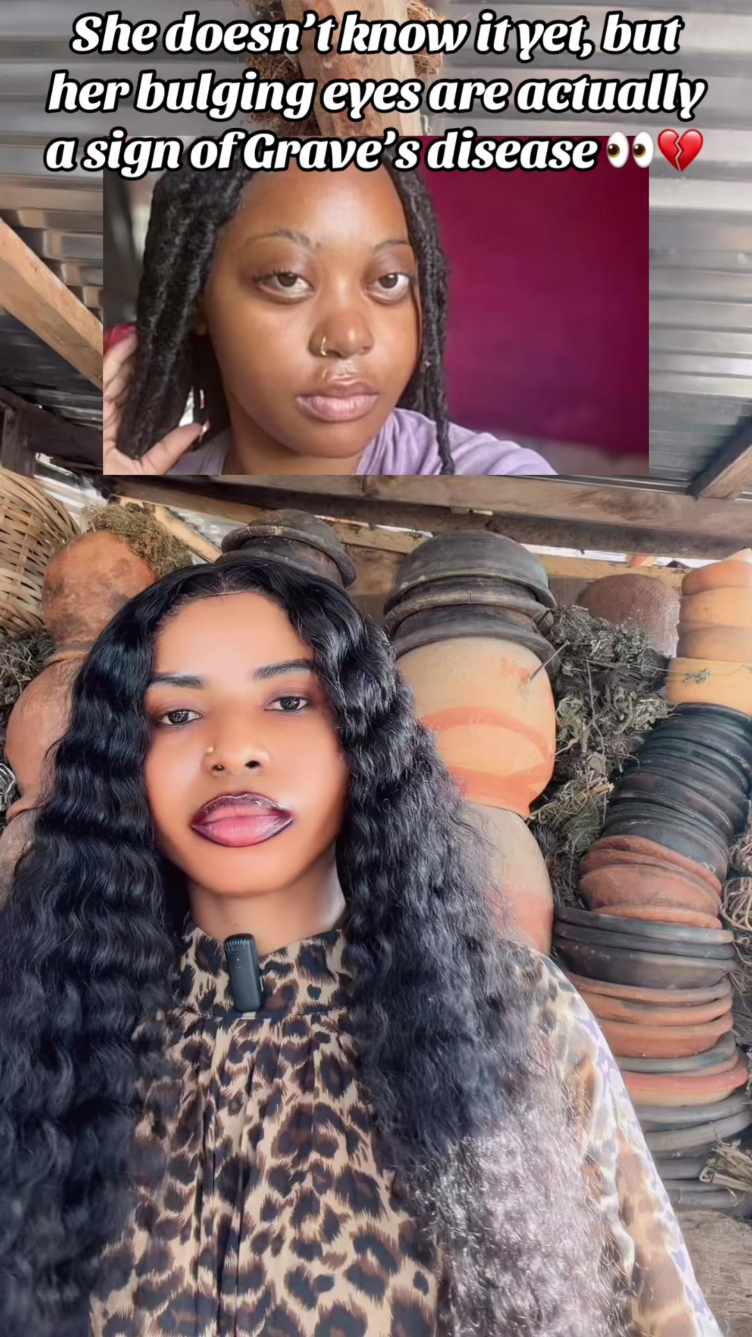 @GeNz_alagbo🐍🍯