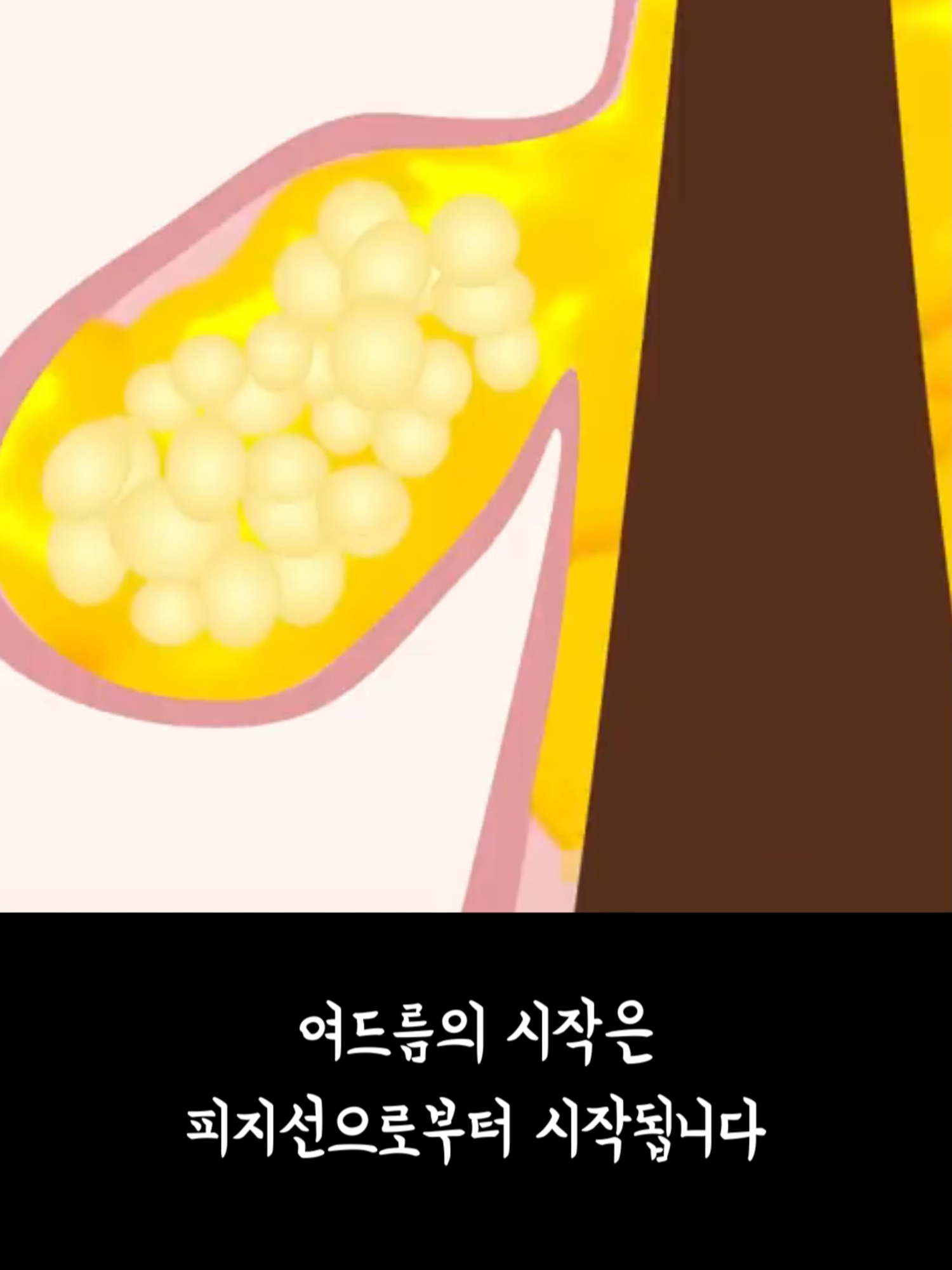 @오구망구