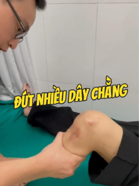 @Chuyên gia xương khớp