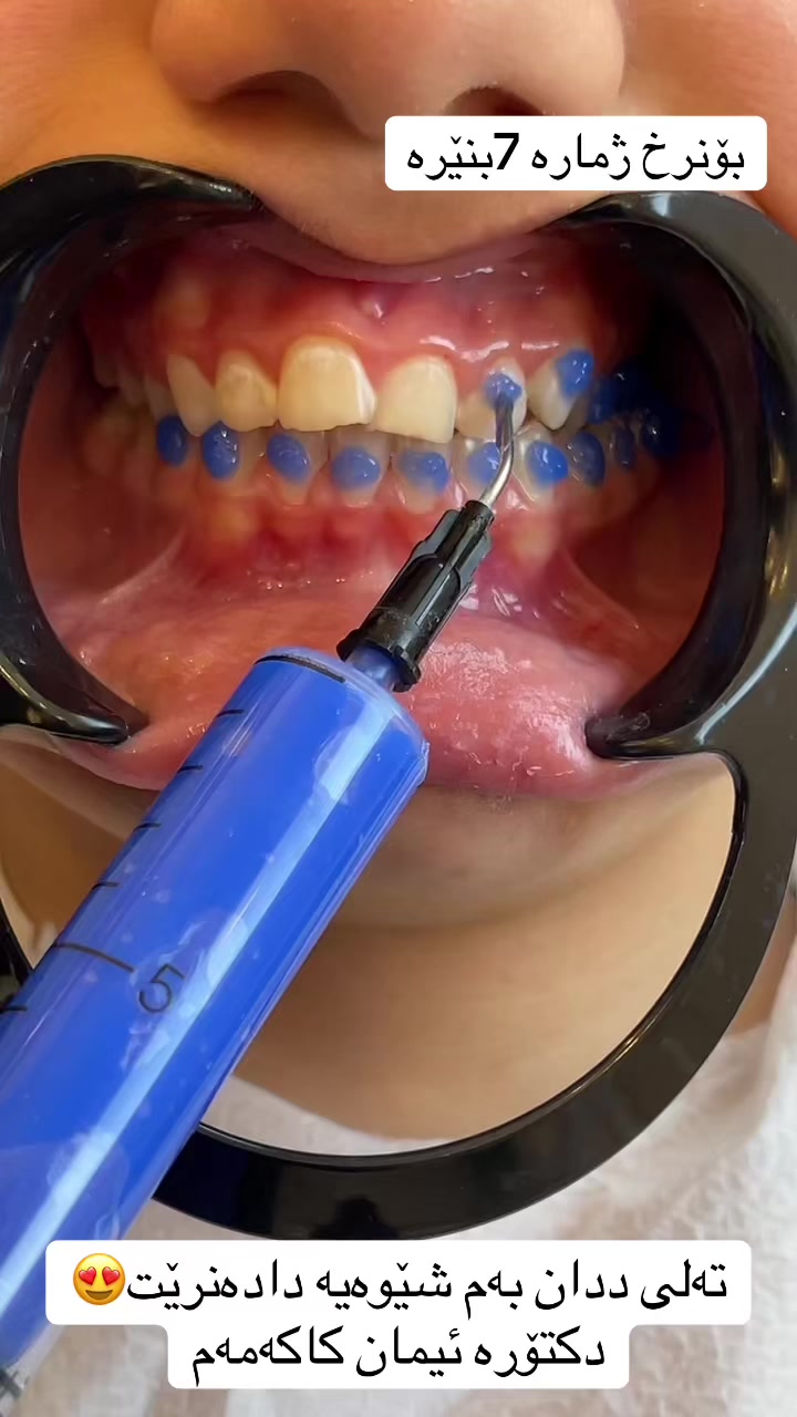 @🦷 دکتۆرە ئیمان کاکەمەم