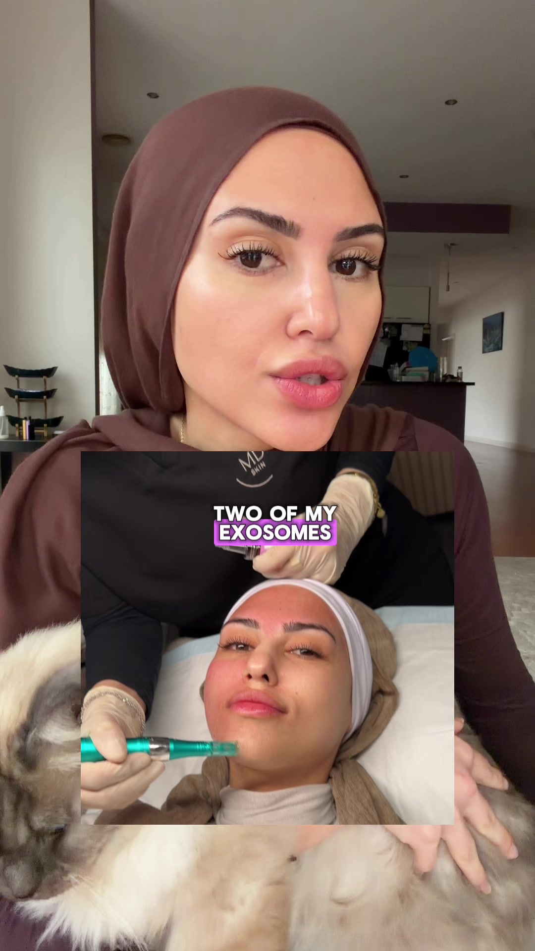 @Ümz✨
