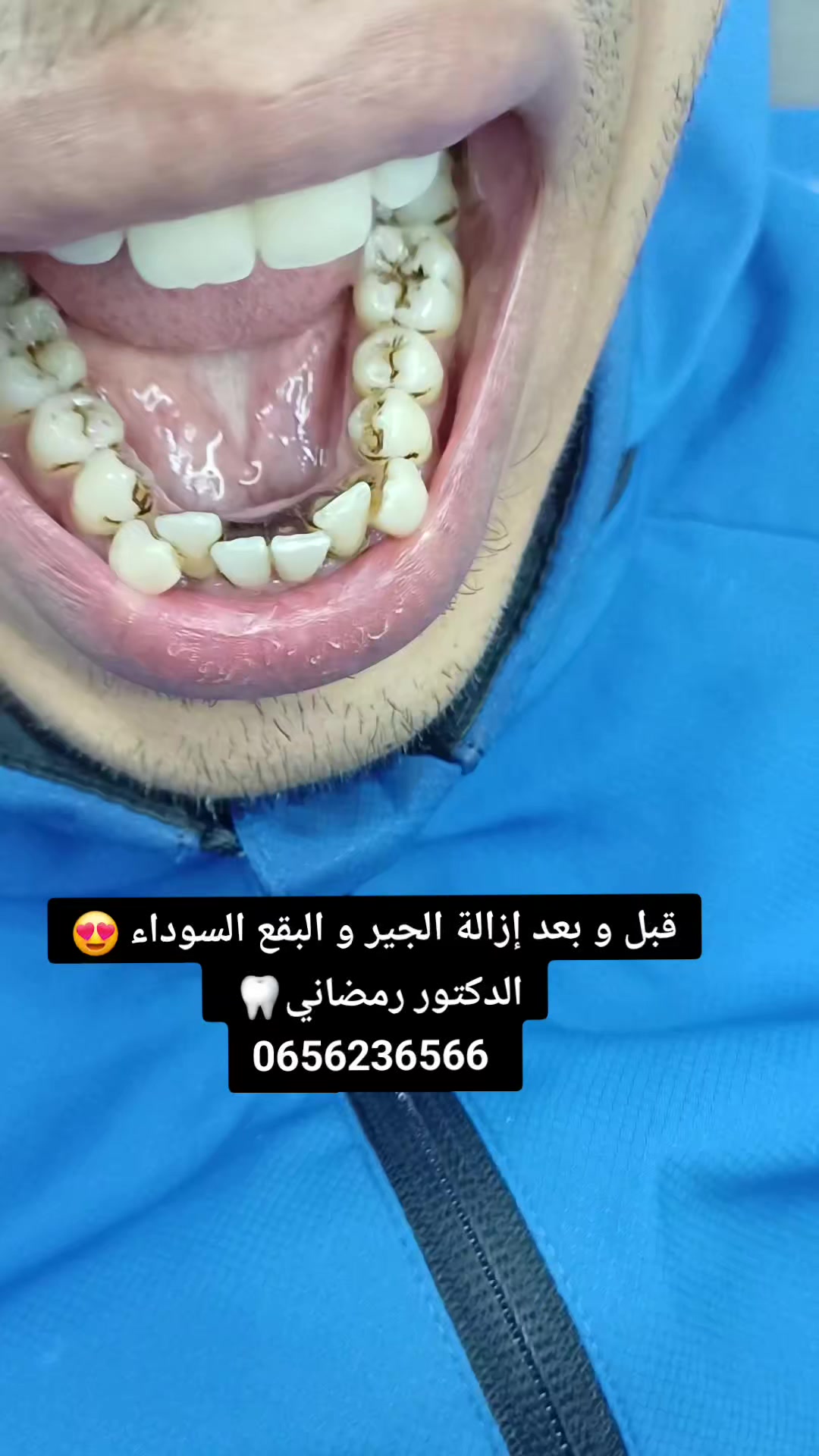 @Dr Ramdani Rassim