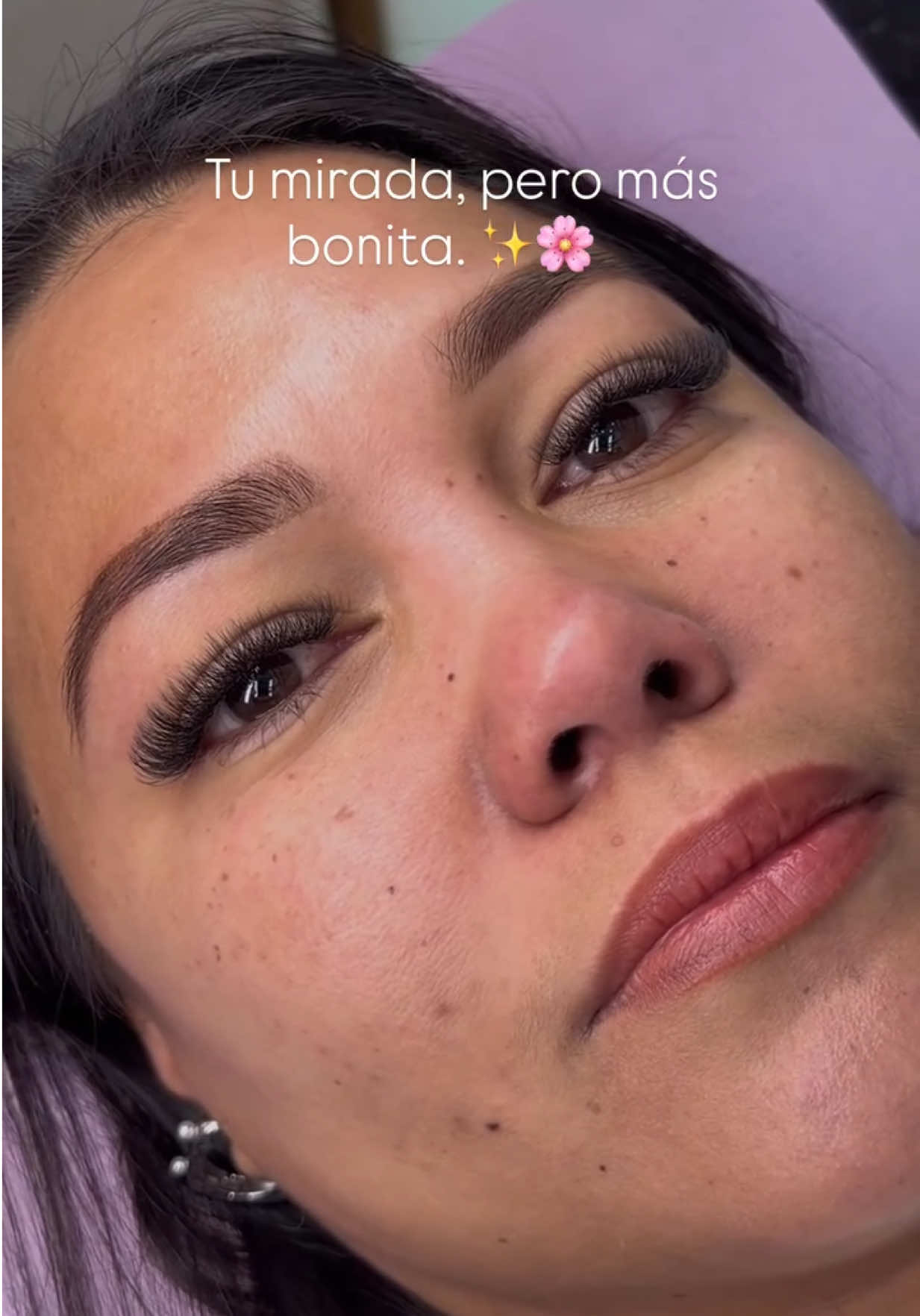 @CherryBomb