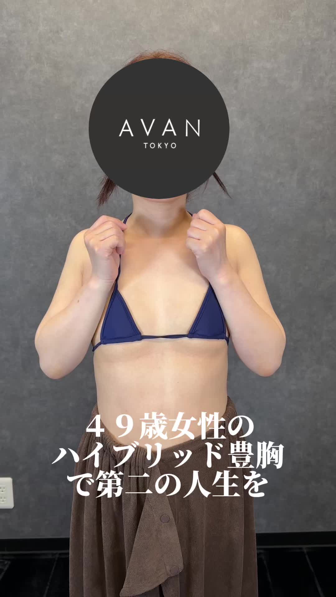 @森脇進/二の腕脂肪吸引・豊胸/AVAN TOKYO