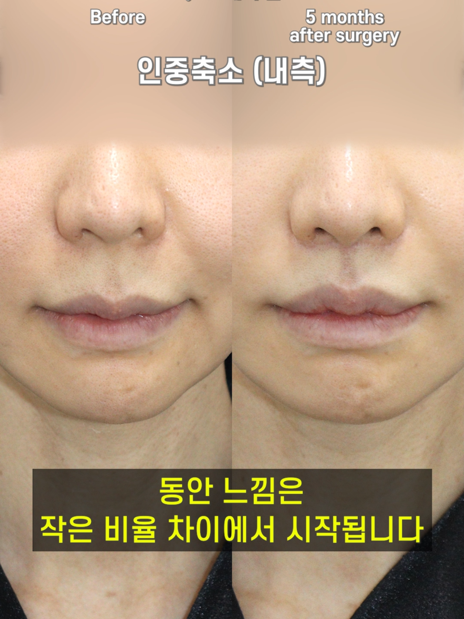 @다시피움성형외과 DASIPIUM タシピウム