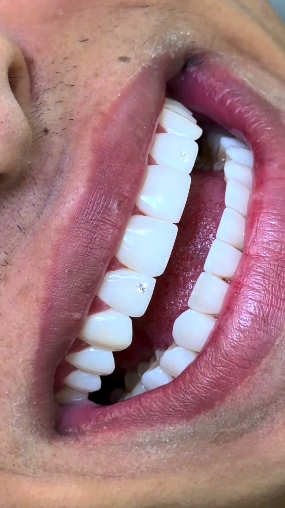 @Smiledent
