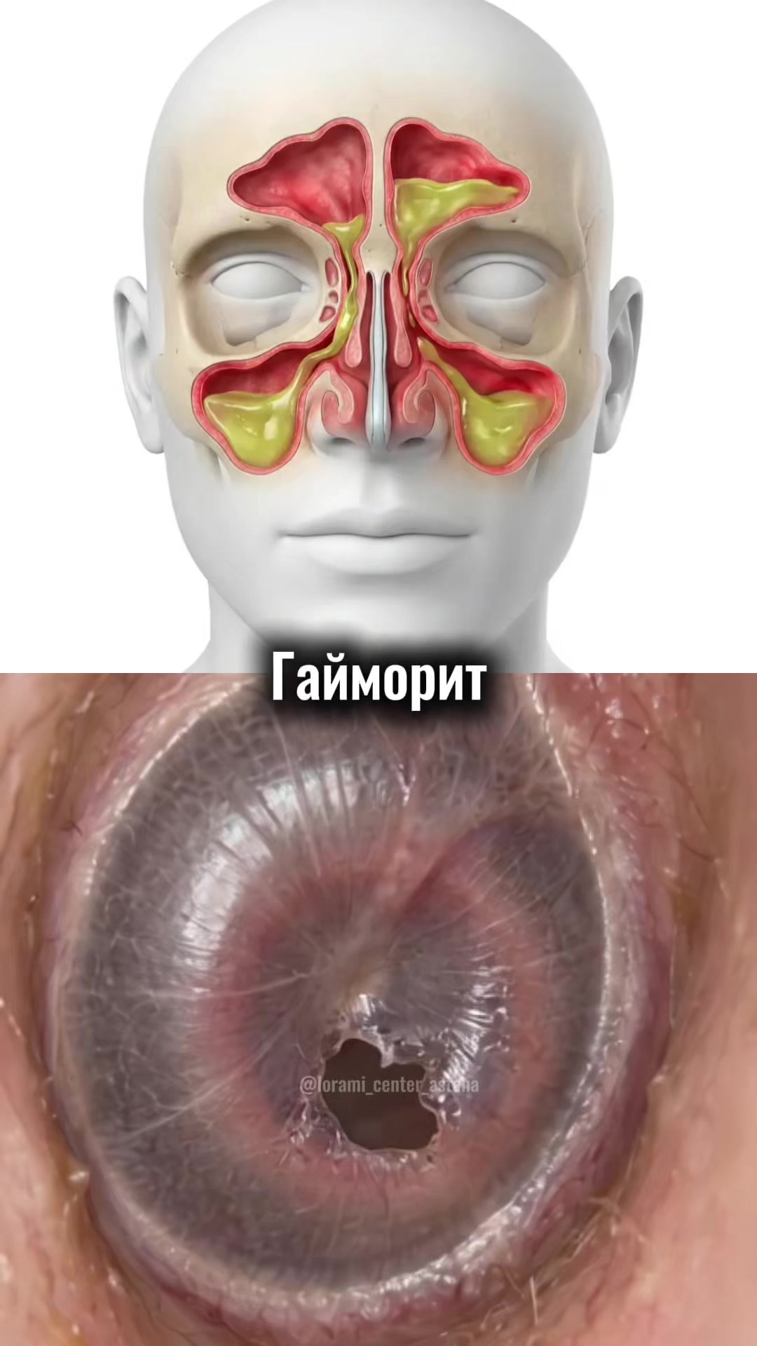 @Lorami_center_astana