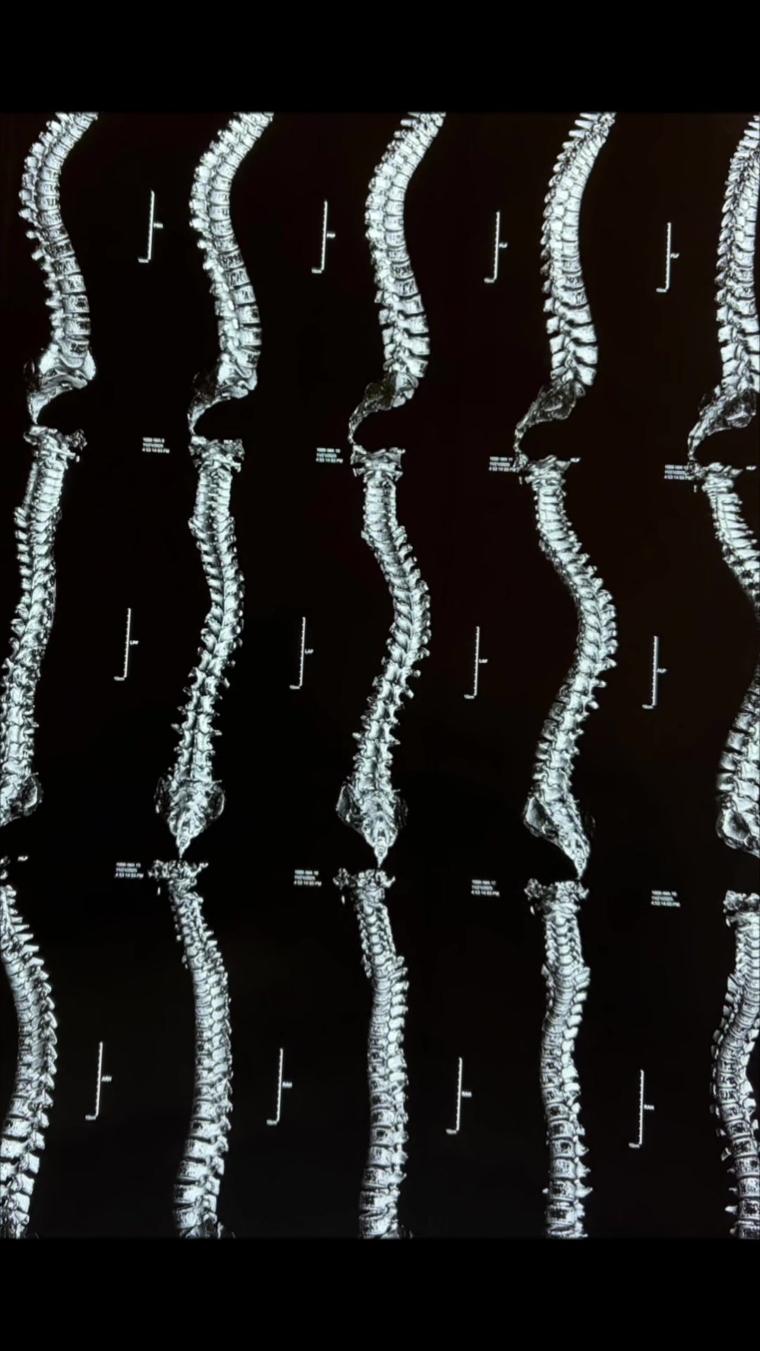 @Orthopedic_Surgeon_Arbind