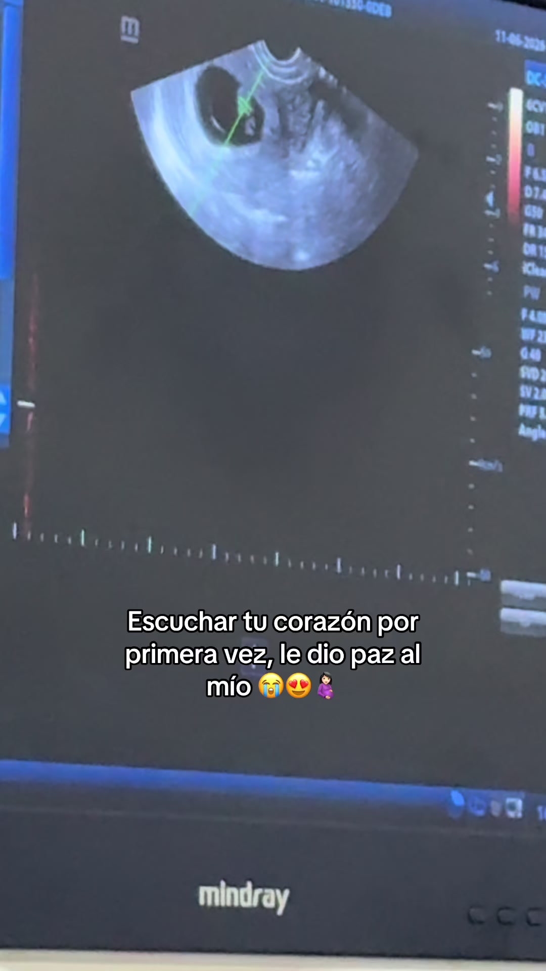 @Angie