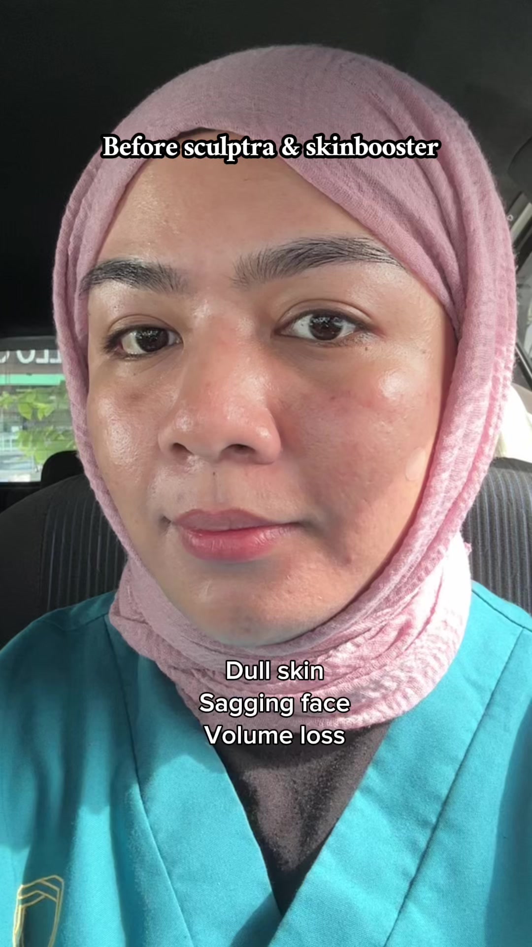 @nuwanaaaaaaa