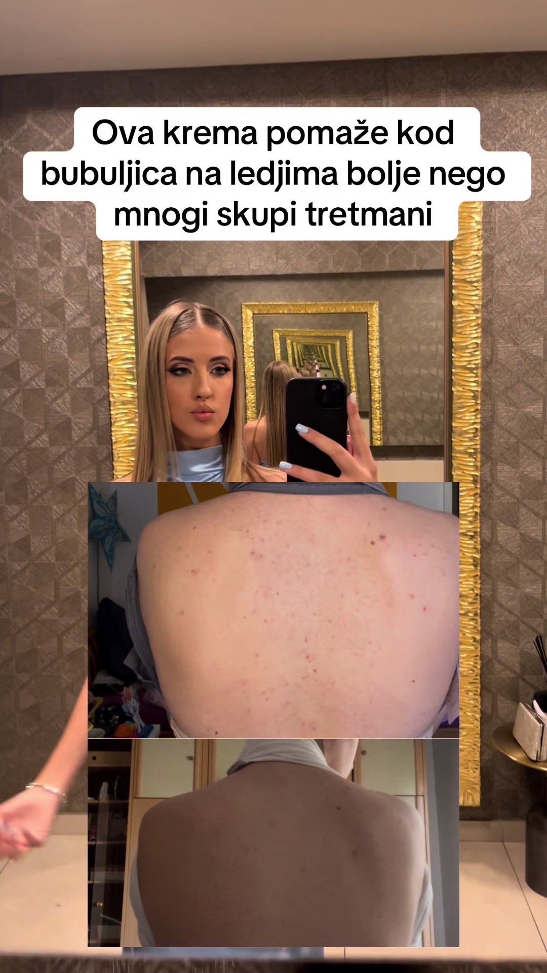 @obrisii.flekice