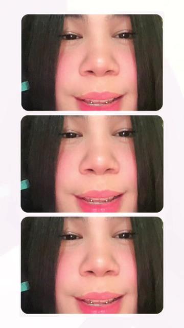 @duglenis torres😘😘