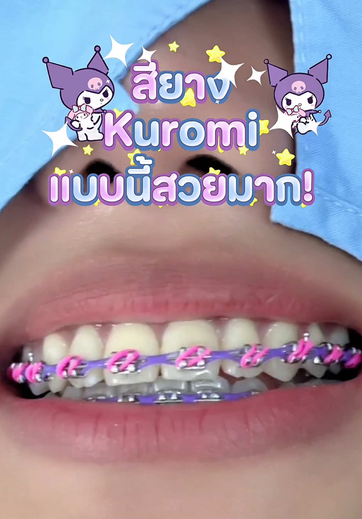 @ideasmilebu