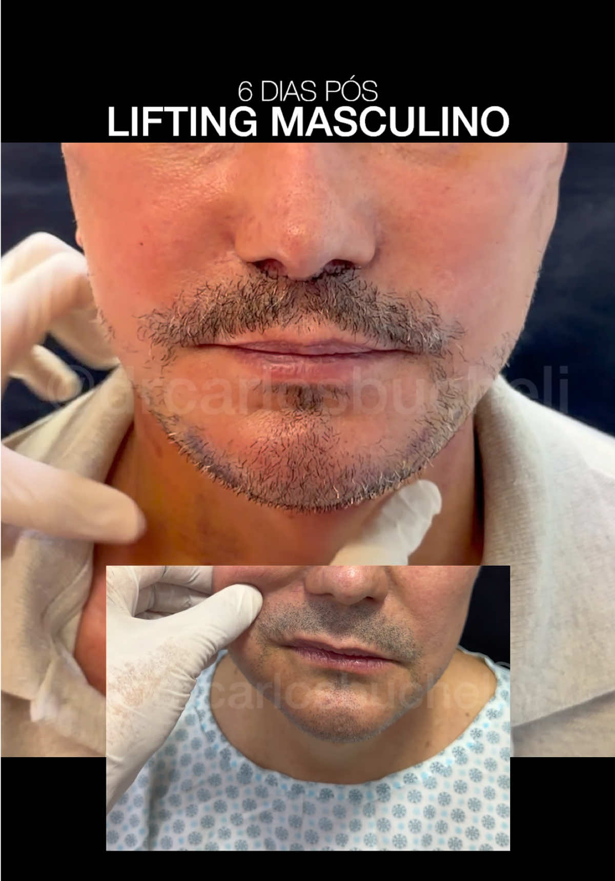 @Dr. Carlos Bucheli