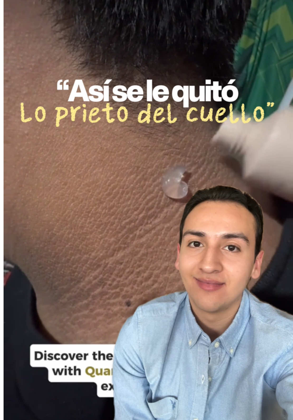 @Club Disminulina