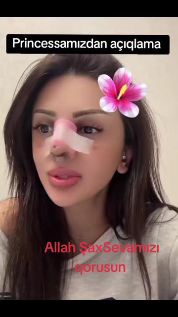 @NАТА (Сева♥️Шах)🇦🇿✅🎤🎭