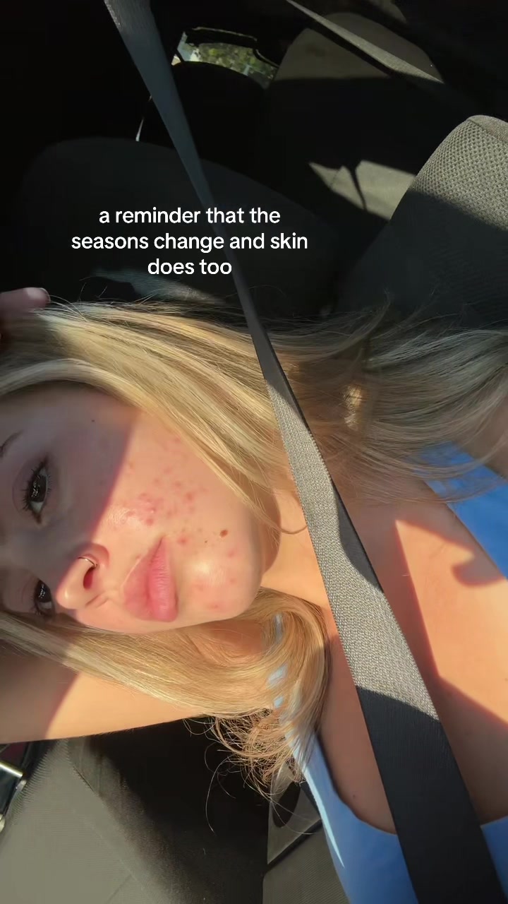 @cheeto🙈